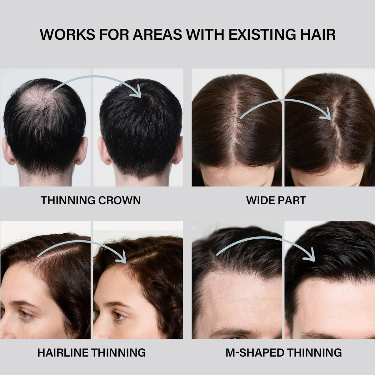 Seaboll natural mineral-based hair fibers applied to a patchy beard for instant thickness.