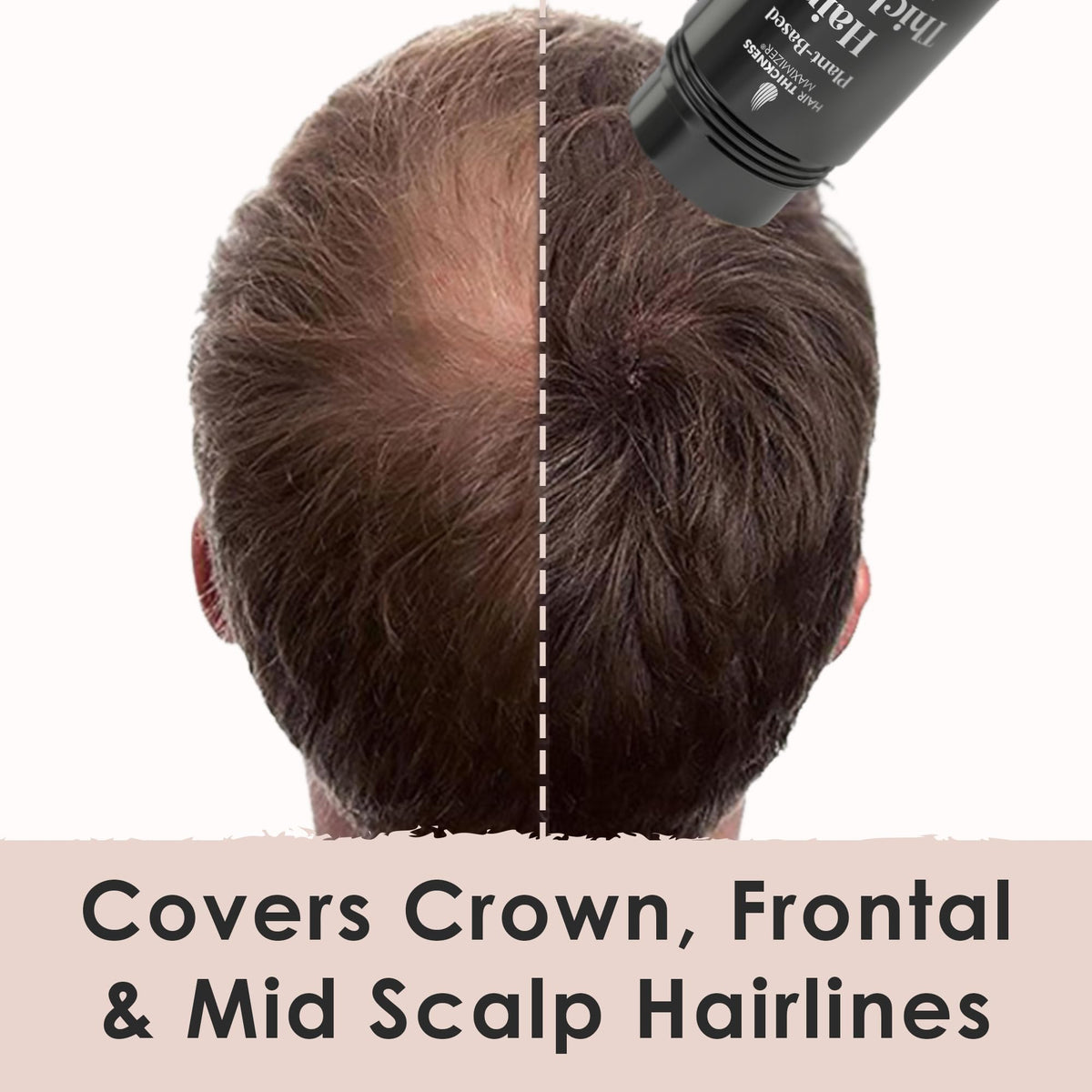 Non itchy second generation hair loss concealer bottle with cap off