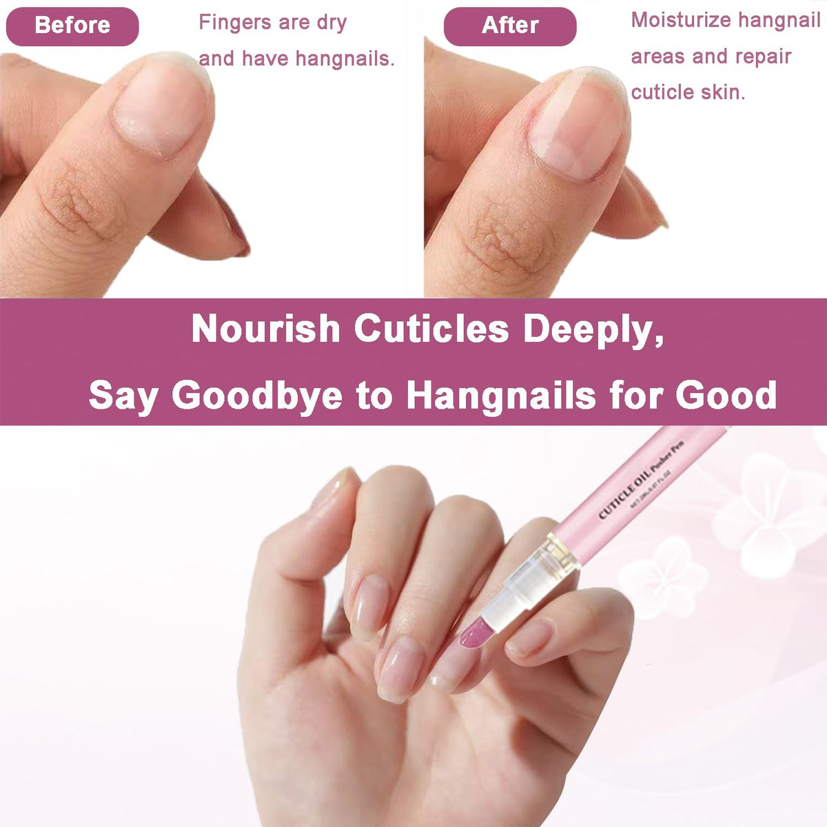 Instructional view demonstrating the 45 degree angle use of the ceramic cuticle buffer on natural nails