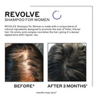 Close up of Zenagen Revolve branding