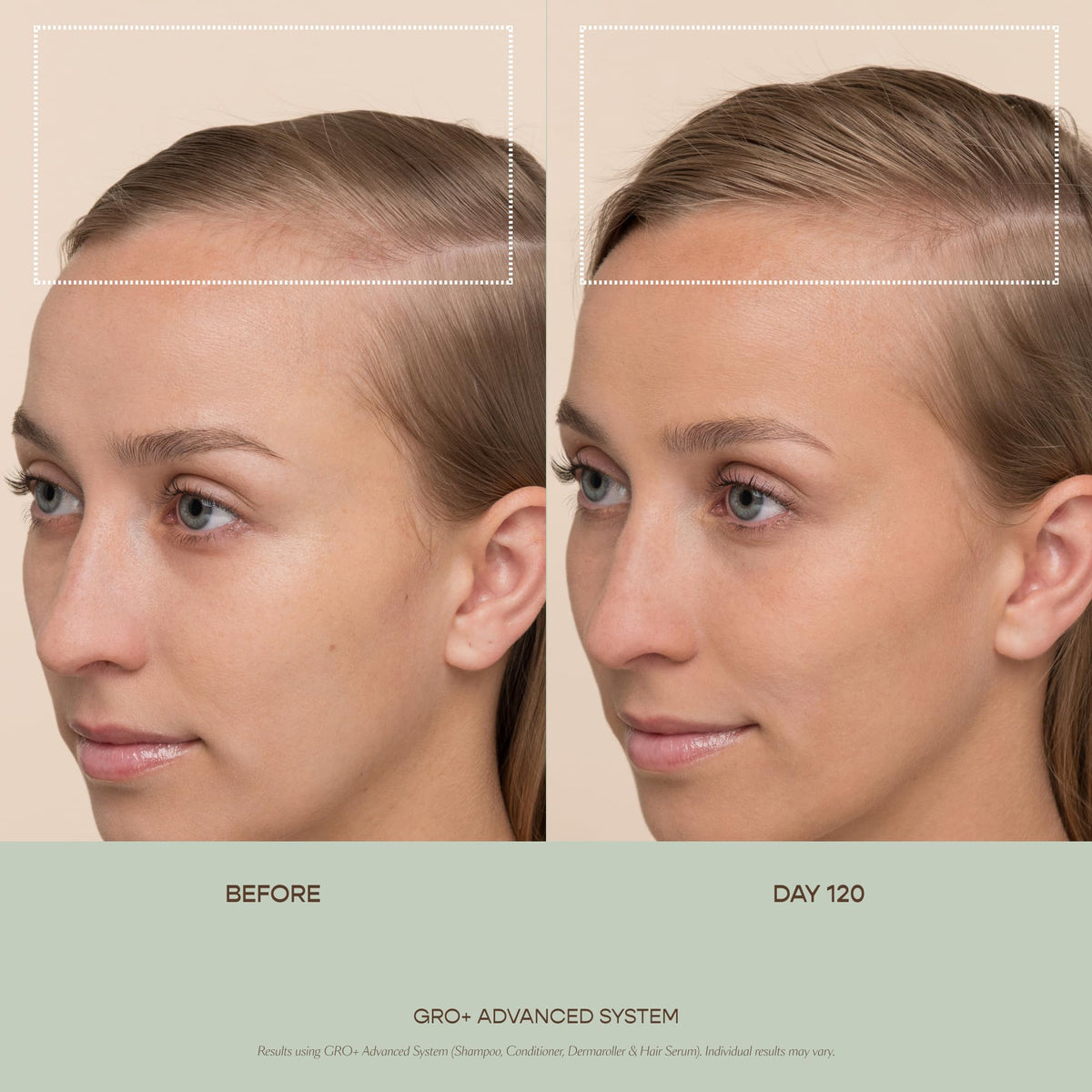 Vegamour Gro Plus Advanced Balancing Conditioner for thinning hair