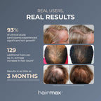 Side view of Hairmax RegrowMD device on a model