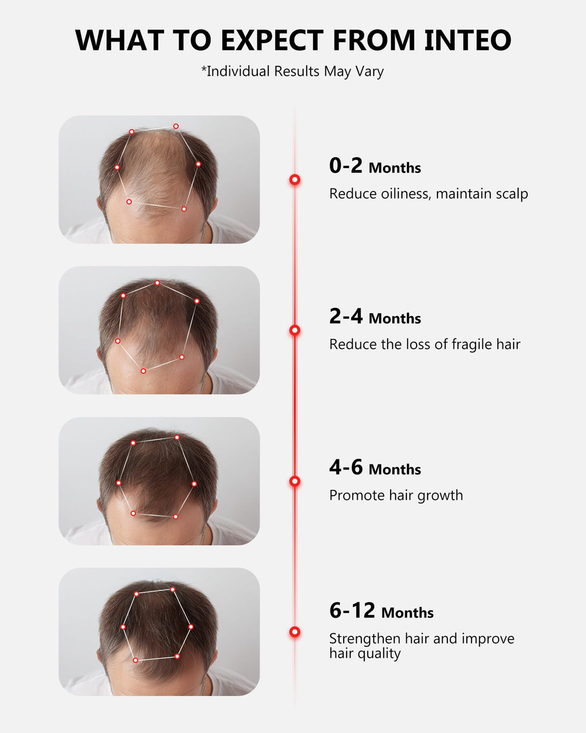 Inteo hair therapy device showing internal laser coverage