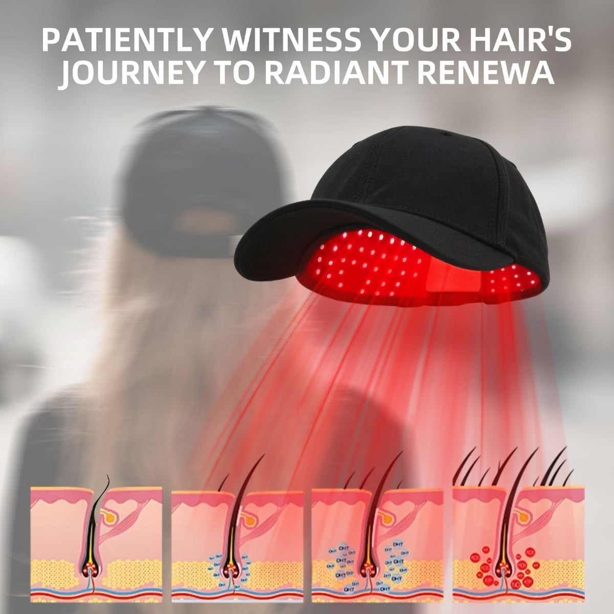 Side profile of Hairo hair loss treatment cap