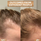 Detailed view of LED diodes inside hair growth cap
