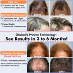 Close up of AmaBiuty LED hair growth technology
