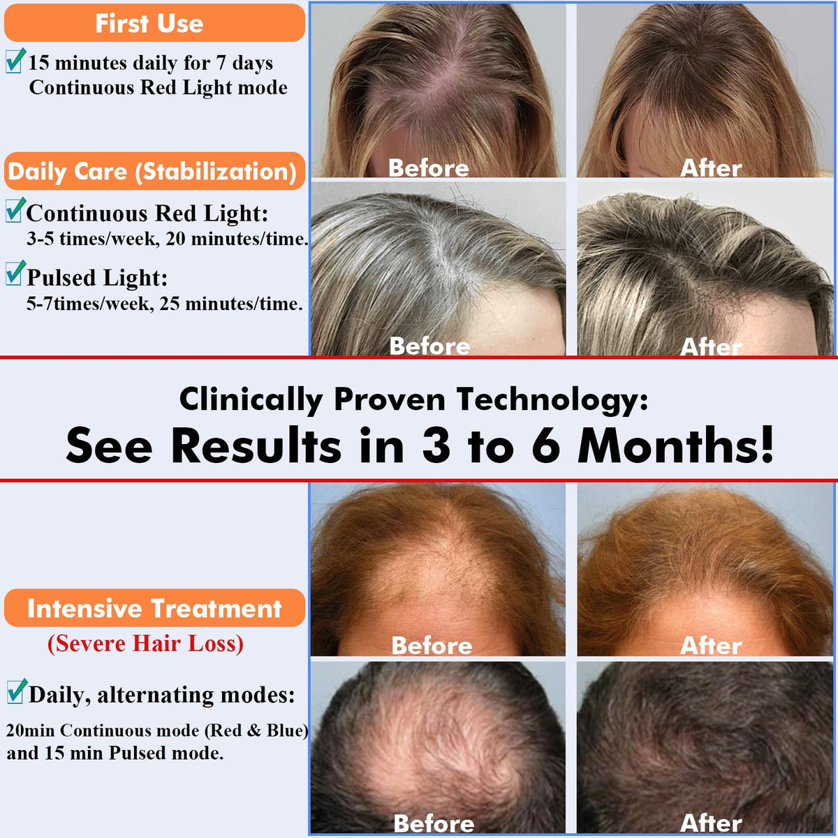 Close up of AmaBiuty LED hair growth technology