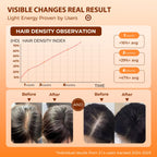 Side profile of Protouch laser therapy device for hair loss