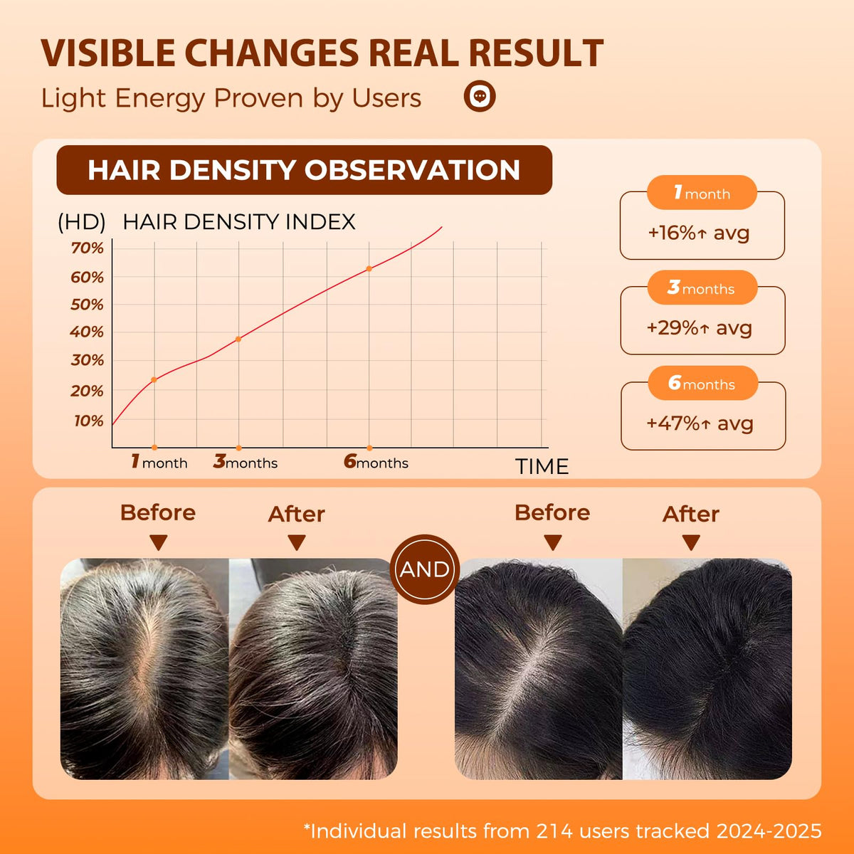 Side profile of Protouch laser therapy device for hair loss