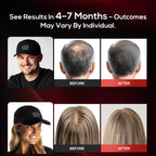 Vicmama LLLT hair regrowth device side profile