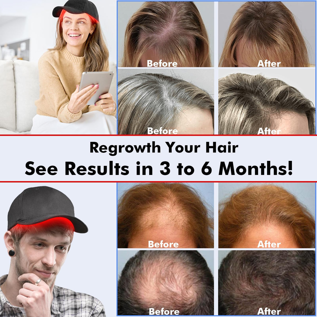 Close up of hair regrowth light therapy technology