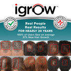 IGrow hair rejuvenation system side profile showing design