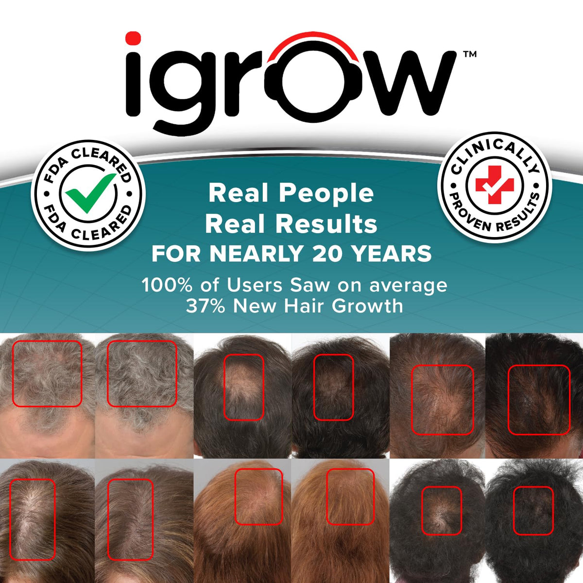 IGrow hair rejuvenation system side profile showing design