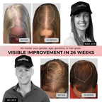 Capillus Pro laser hair therapy device side profile