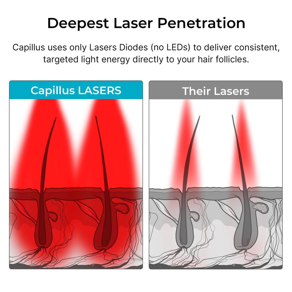Man using Capillus Pro laser hair loss treatment cap