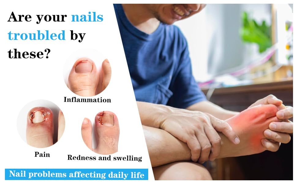 Instructions for applying Abeillo nail corrector strips