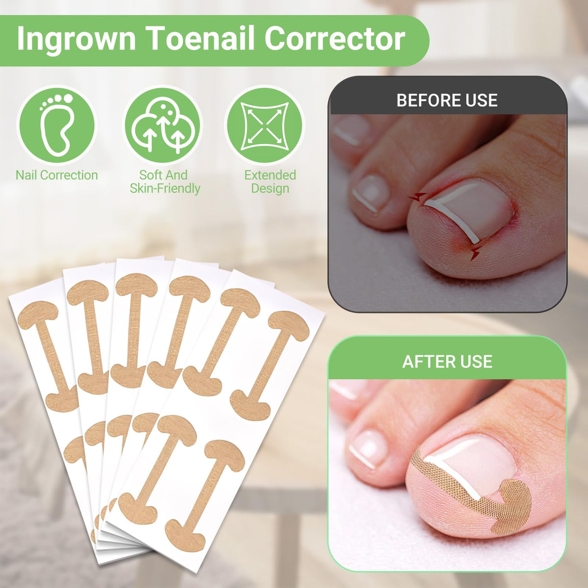 Flat-head stainless steel nail clippers designed for straight-across cutting to prevent ingrown toenails