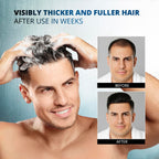 Spartan hair loss treatment shampoo packaging box showing ingredients