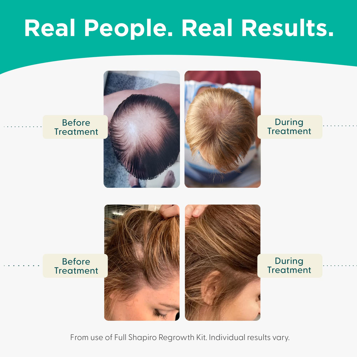 Shapiro MD vegan formula sulfate free shampoo for thicker looking hair