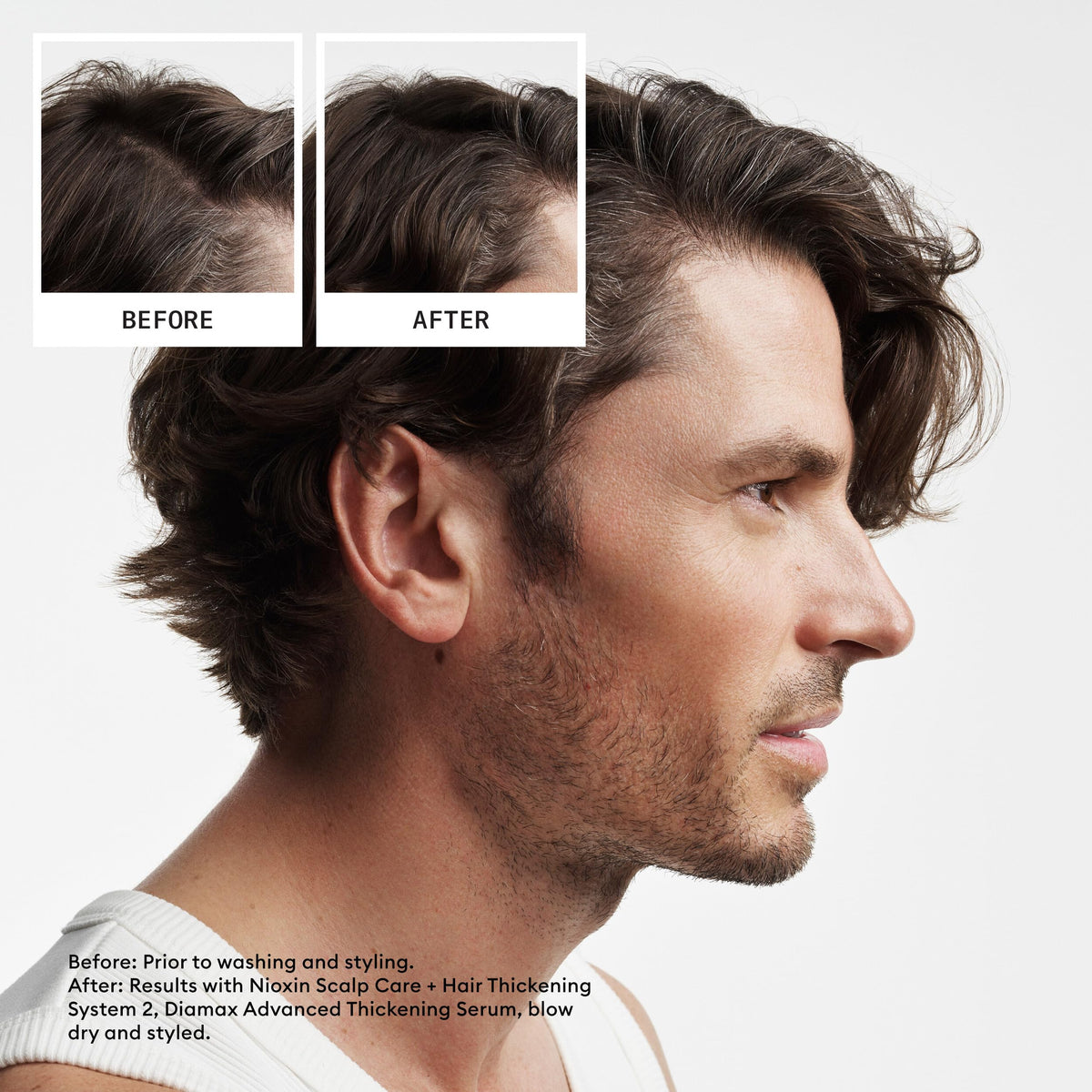 Nioxin System 2 Cleanser Shampoo for natural hair with progressed thinning displaying authentic USA import packaging.