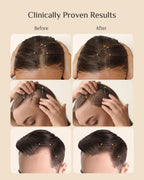 Japanese engineered hair loss serum for men featuring nanocapsule technology details