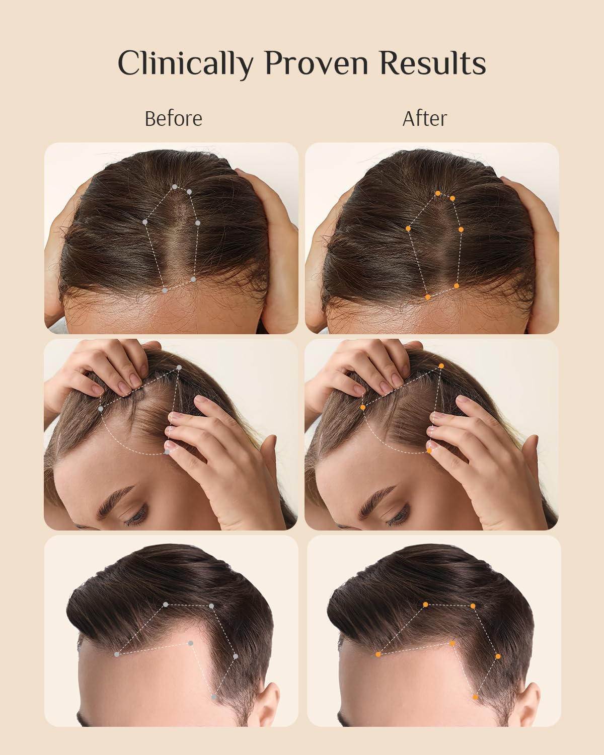 Japanese engineered hair loss serum for men featuring nanocapsule technology details
