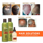 Peter Lamas Hair Solutions system showcasing its plant stem cell and peppermint oil scalp therapy