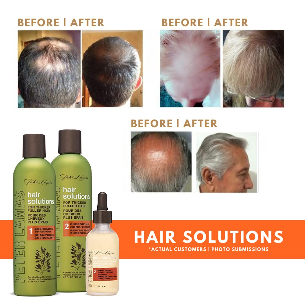 Peter Lamas Hair Solutions system showcasing its plant stem cell and peppermint oil scalp therapy