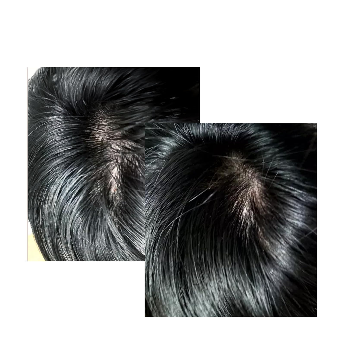 Non greasy Celonia hair treatment serum applied directly to thinning scalp area