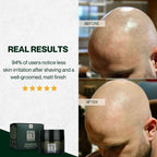 Dermatologist tested German bald care cream for zero to three millimeter shaved scalps