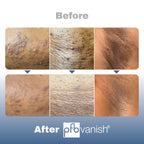 Side view of PFB Vanish Ultra dark spot remover packaging