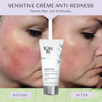 Yonka anti redness rosacea treatment face cream texture sample