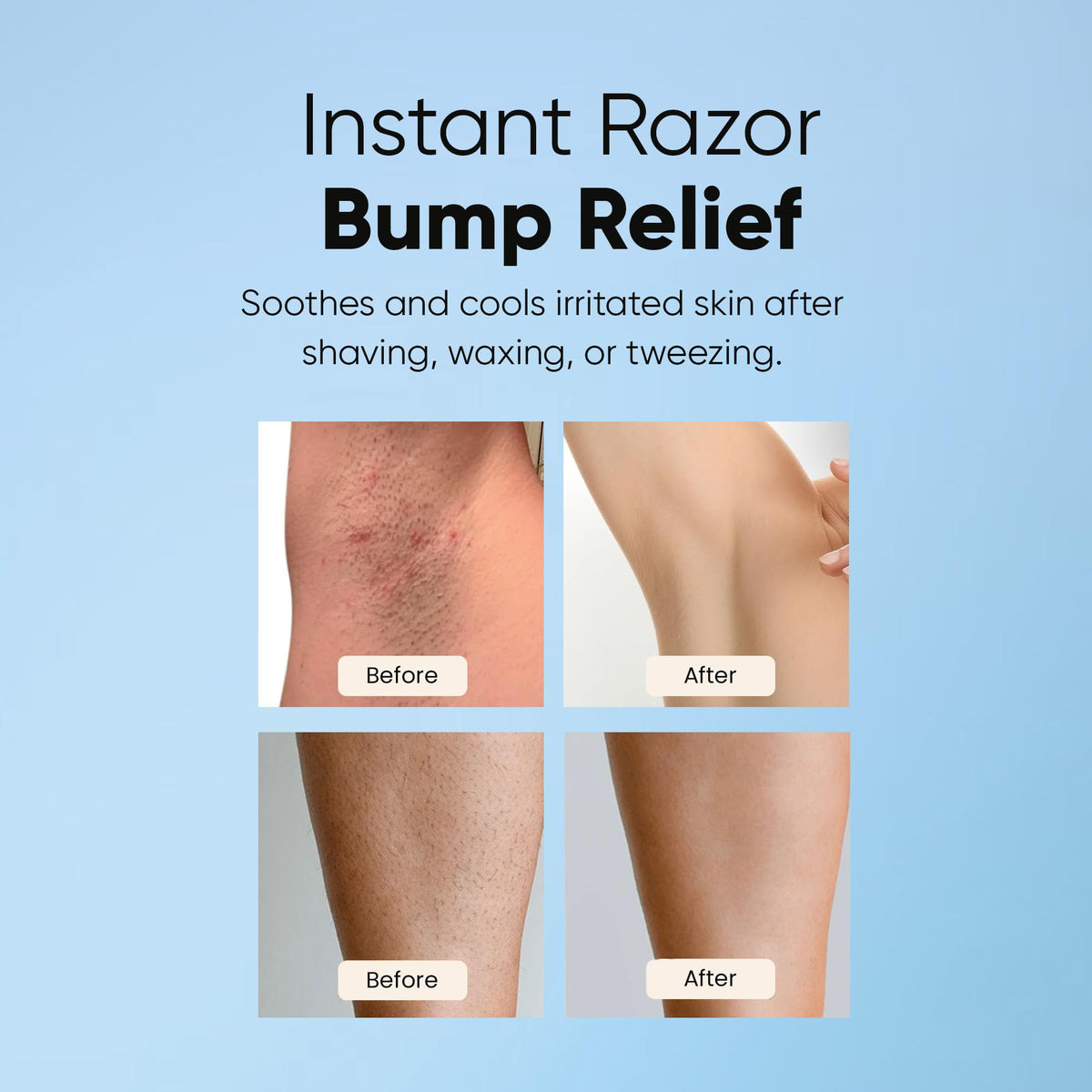 ESTETIST post shave serum being applied to sensitive bikini area skin to prevent redness