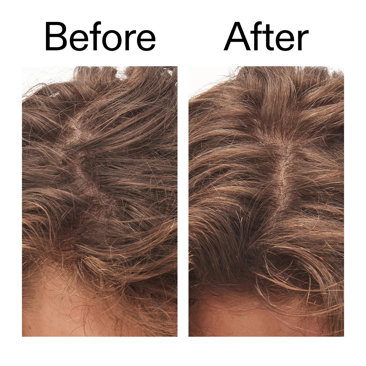 The Inkey List Glycolic Acid Exfoliating Scalp Scrub lifestyle application