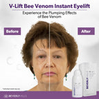 Beverly Hills V-Lift serum for puffy eyes and dark circles