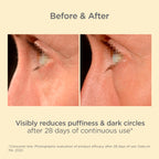 ISDIN K-Ox Eyes applicator details for dark circles