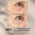 StriVectin anti-aging eye serum for sagging skin