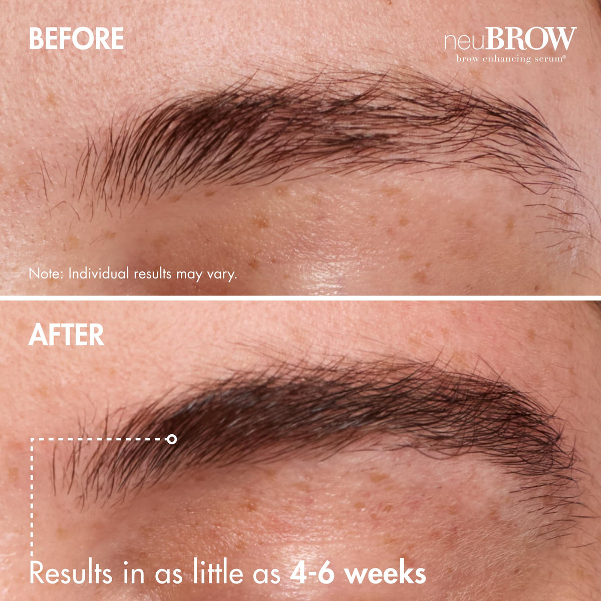 Clinical brow serum for fuller hair