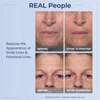 Authentic USA imported Plexaderm serum for fine lines and crow feet