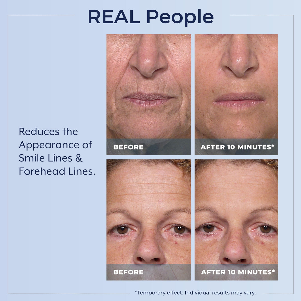 Authentic USA imported Plexaderm serum for fine lines and crow feet