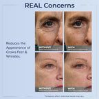 Plexaderm Rapid Reduction Serum display box and product