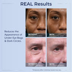 Instructions and benefits of Plexaderm eye serum for facial lines