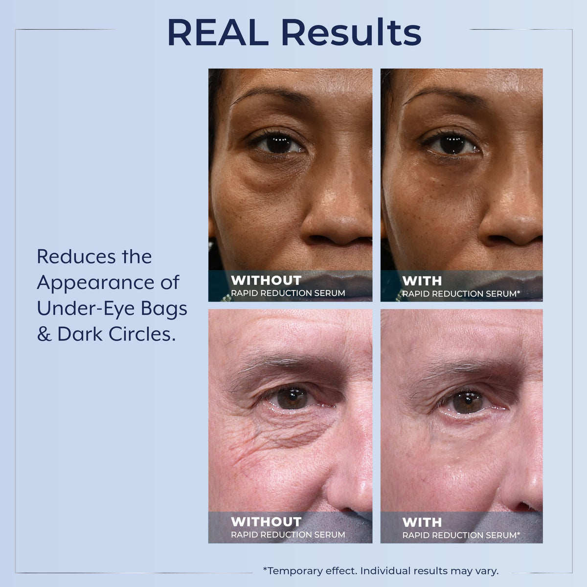 Instructions and benefits of Plexaderm eye serum for facial lines