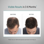 Peak Vitals hair care supplement packaging showing instructions and quality assurance logos.