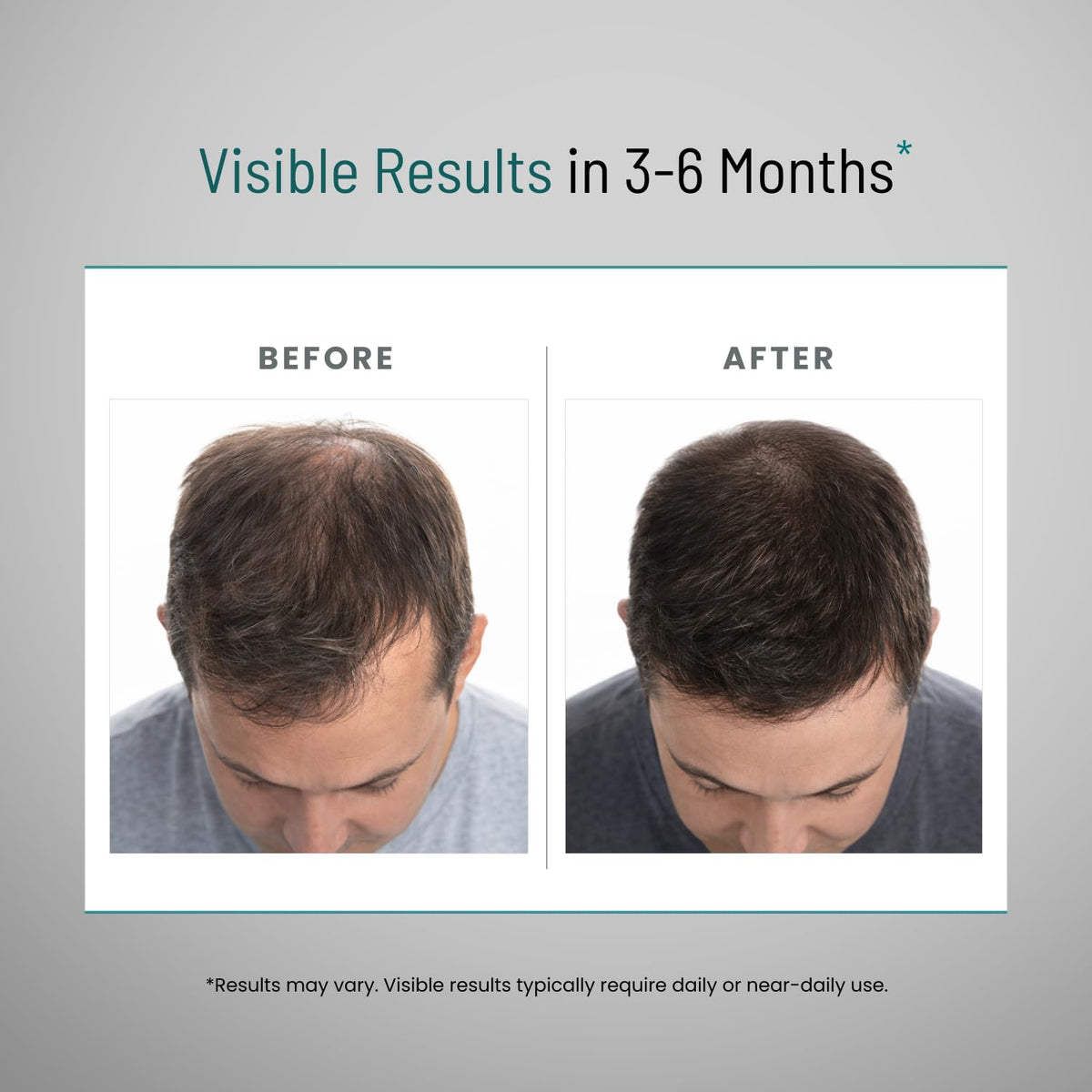 Peak Vitals hair care supplement packaging showing instructions and quality assurance logos.