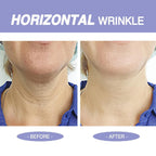 StriVectin anti aging skin tightening cream for face neck and chest overview.