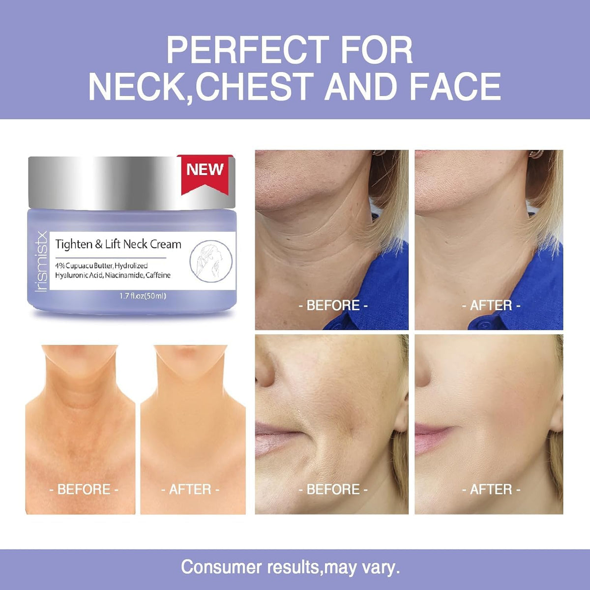 Authentic imported personal care skin tightening treatment for daily routine.