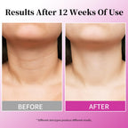 Mrlilei lifting cream for sagging skin on counter