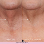 Texture and consistency of Dekliderm retinol neck cream