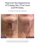 Authentic USA imported Alastin neck cream product detail